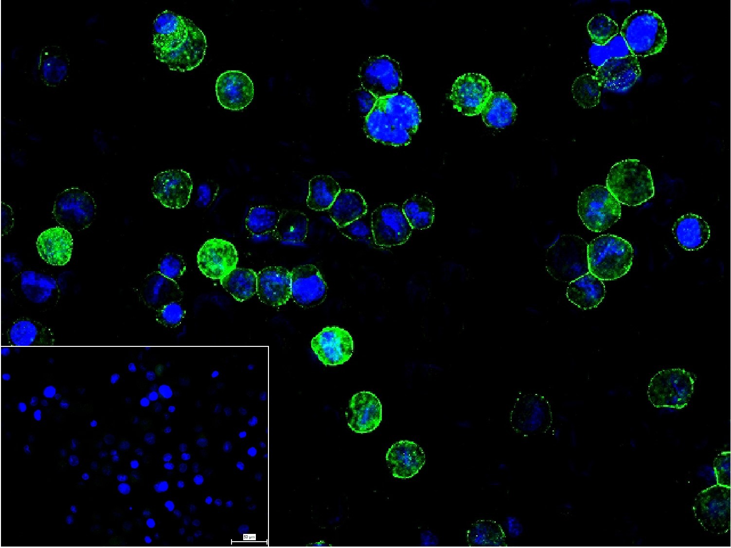 Anti-TNF alpha Polyclonal Antibody