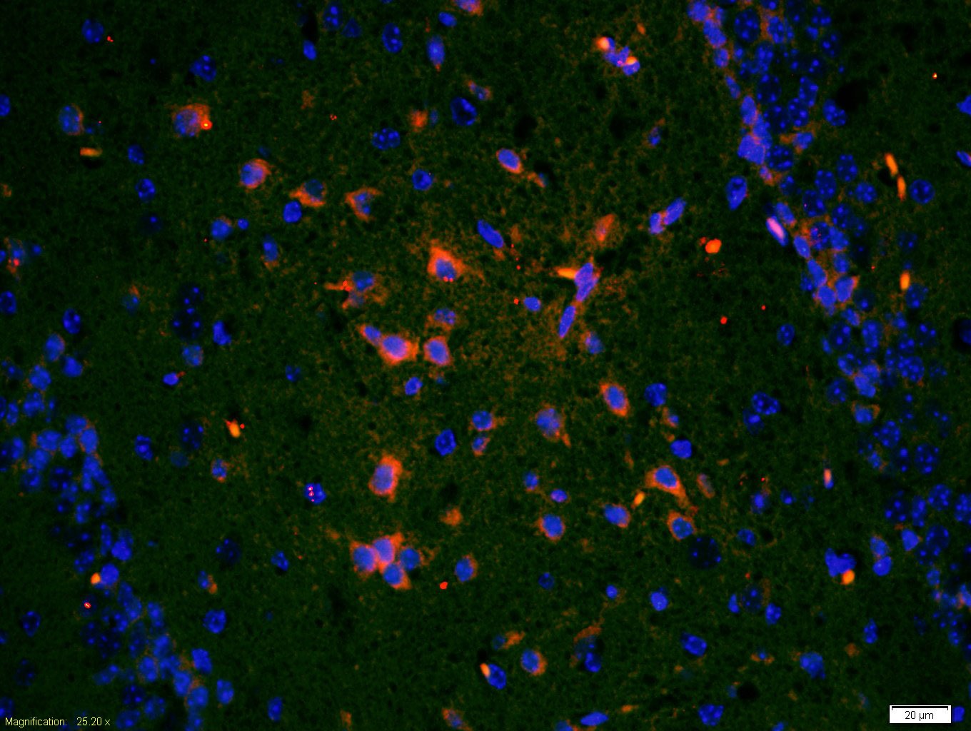 Anti-TrkA Polyclonal Antibody