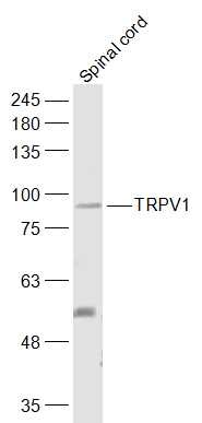 Anti-TRPV1 Polyclonal Antibody