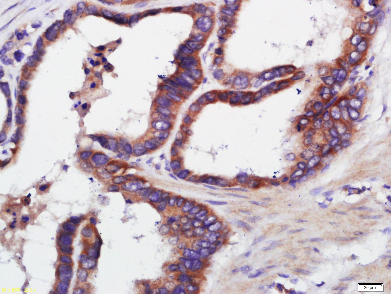 Anti-TERT Polyclonal Antibody