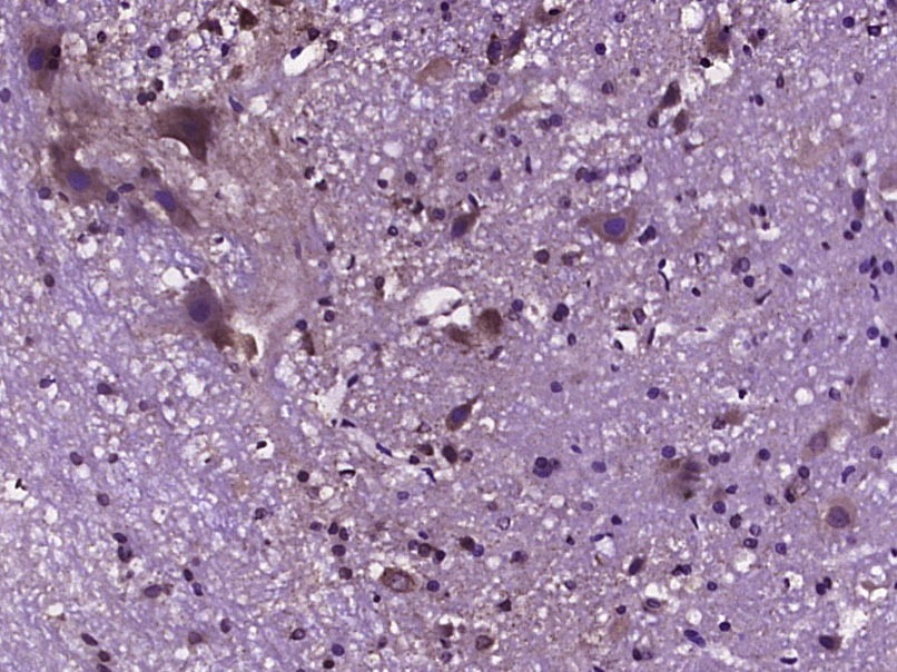 Anti-TRPV1 Polyclonal Antibody 2