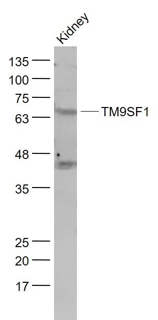 Anti-TM9SF1 Polyclonal Antibody
