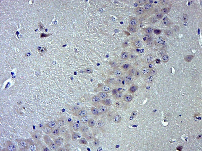 Anti-TRPV1 Polyclonal Antibody