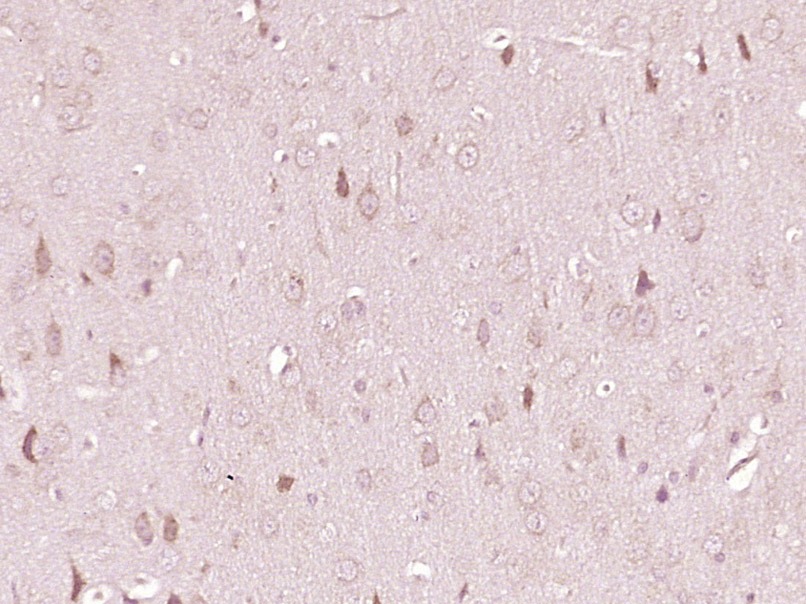 Anti-Tryptophan Hydroxylase 1/TPH-1 Polyclonal Antibody