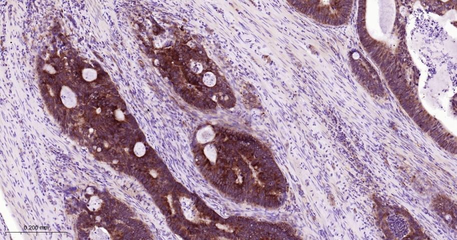 Anti-TNFR2/CD120b/TNFR1B Antibody (1J191)