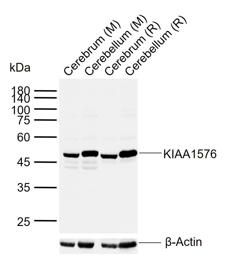 Anti-VAT1L Polyclonal Antibody