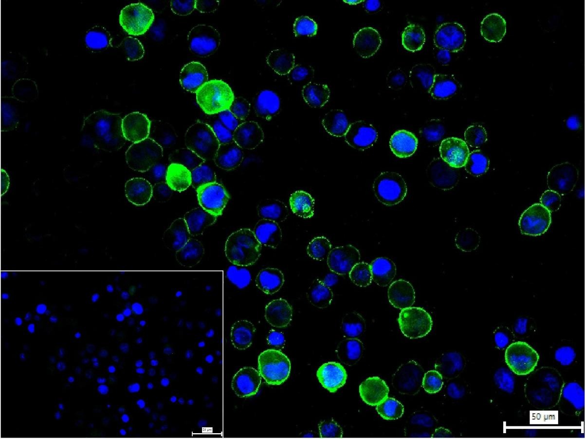 Anti-TNF alpha Polyclonal Antibody 2