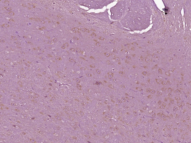 Anti-TMSB4X Polyclonal Antibody