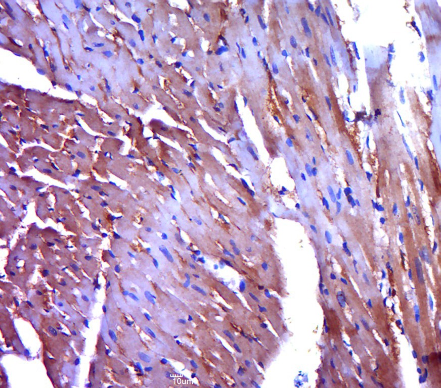 Anti-PYGM Polyclonal Antibody