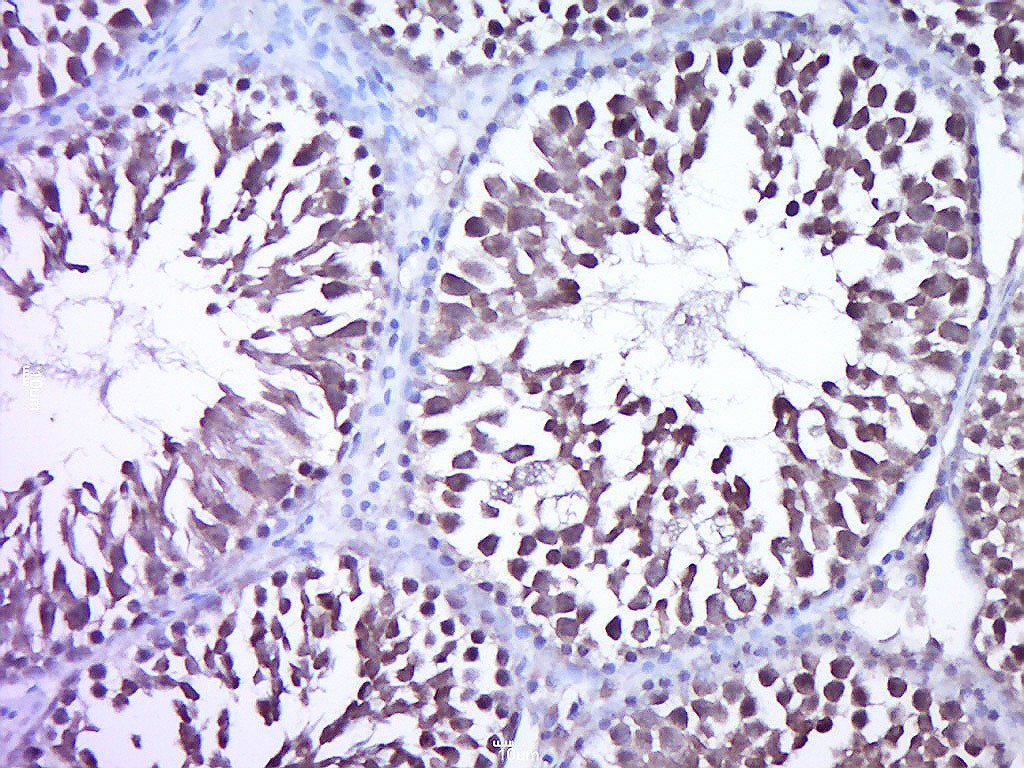 Anti-ROR alpha Polyclonal Antibody