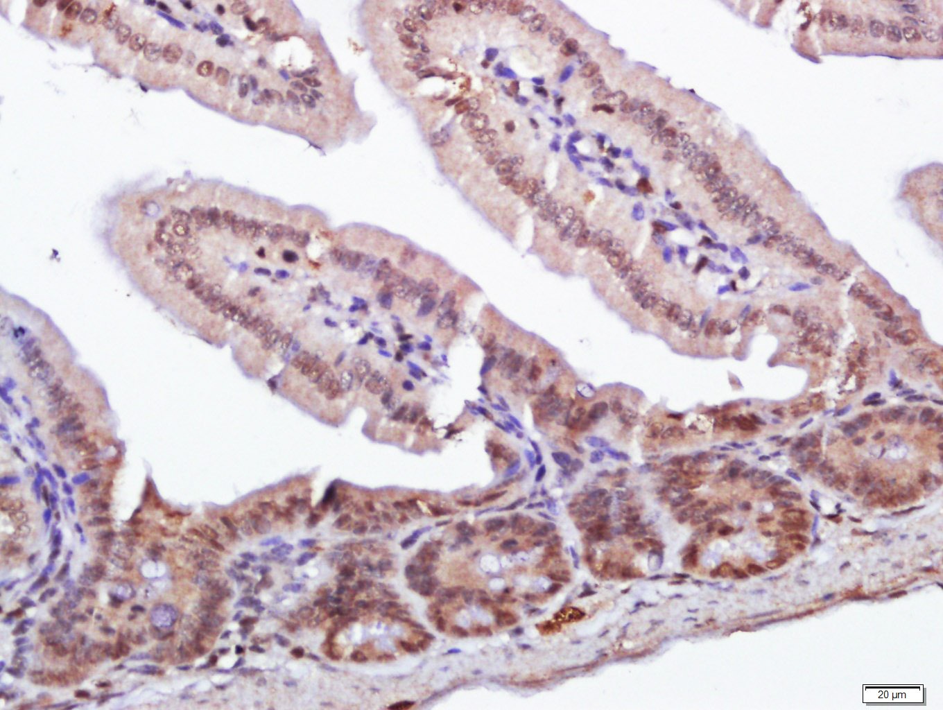 Anti-RORC Polyclonal Antibody 2