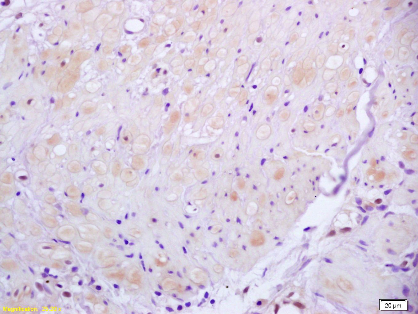Anti-ROCK2 Polyclonal Antibody
