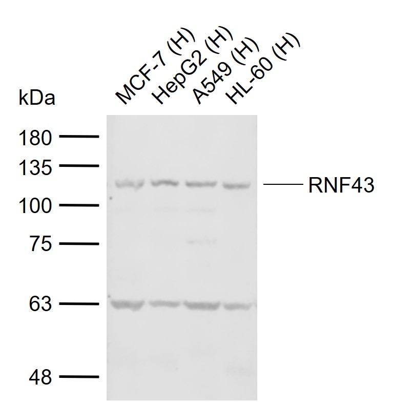 Anti-RNF43 Polyclonal Antibody 2