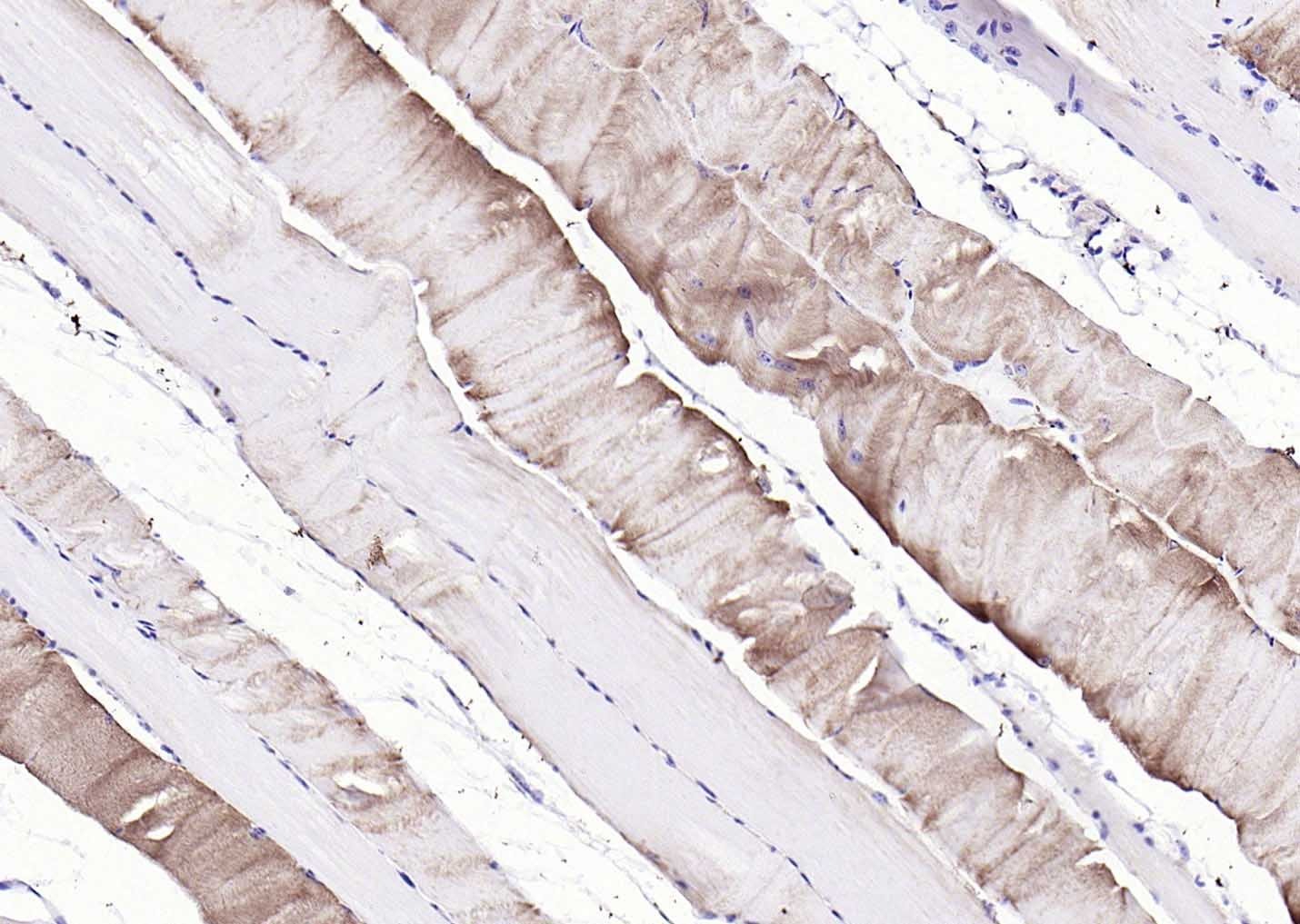 Anti-PYGM Polyclonal Antibody