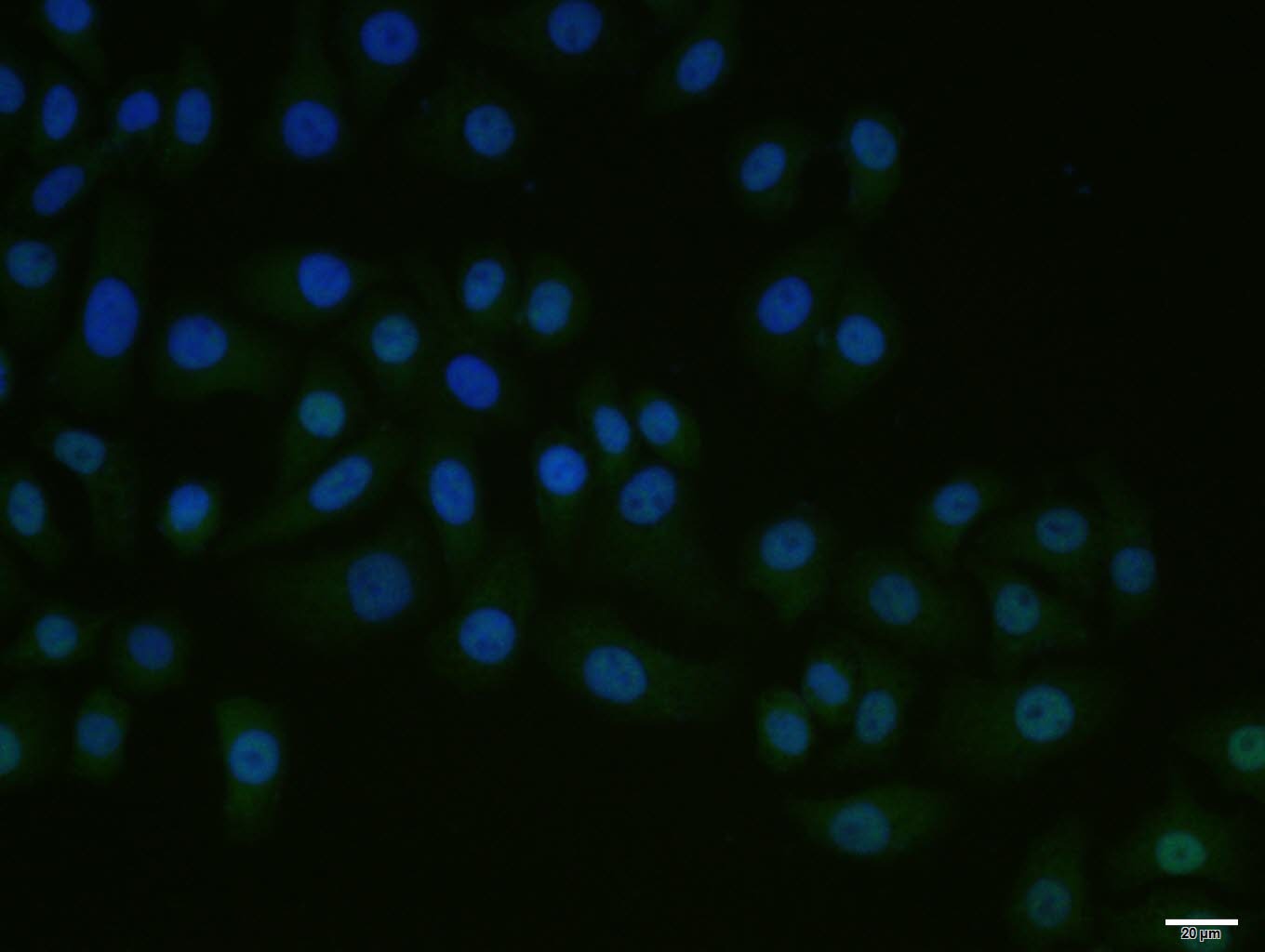 Anti-RORC Polyclonal Antibody 2