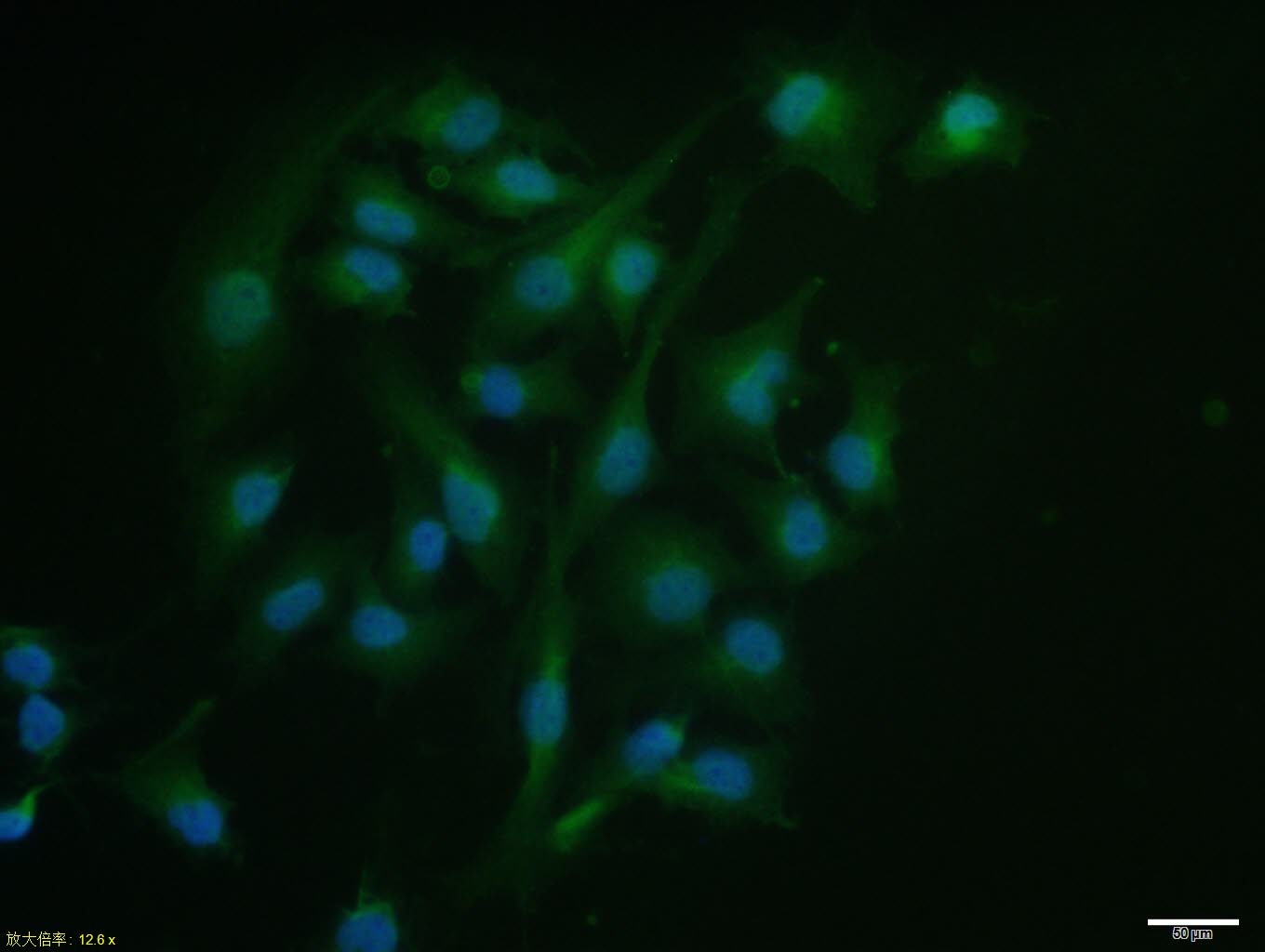 Anti-PTMA Polyclonal Antibody