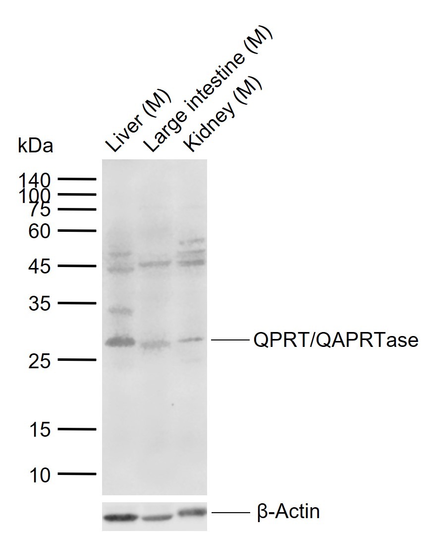 Anti-QPRTase Polyclonal Antibody