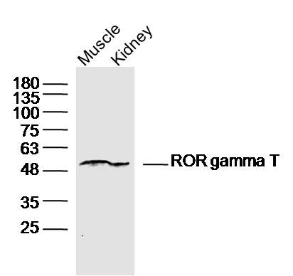 Anti-ROR gamma T Polyclonal Antibody