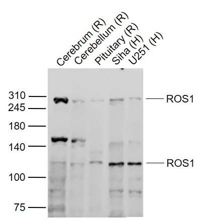 Anti-ROS1 Polyclonal Antibody