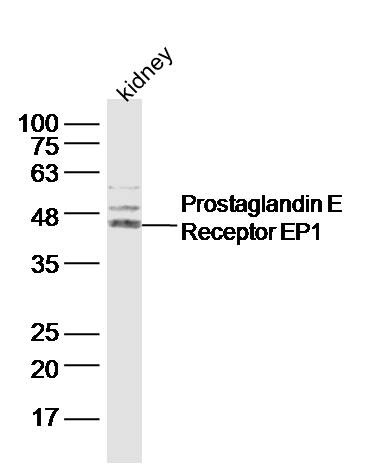 Anti-PTGER1 Polyclonal Antibody