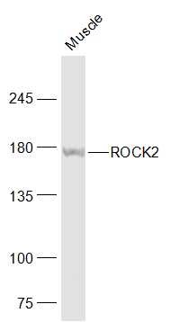 Anti-ROCK2 Polyclonal Antibody