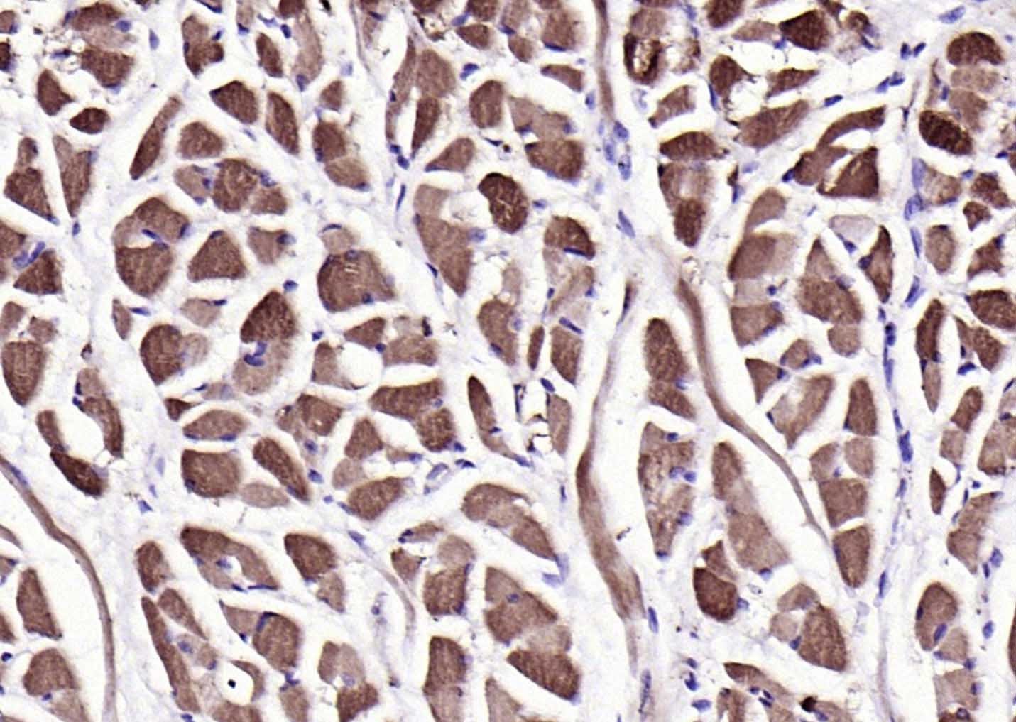 Anti-PYGM Polyclonal Antibody