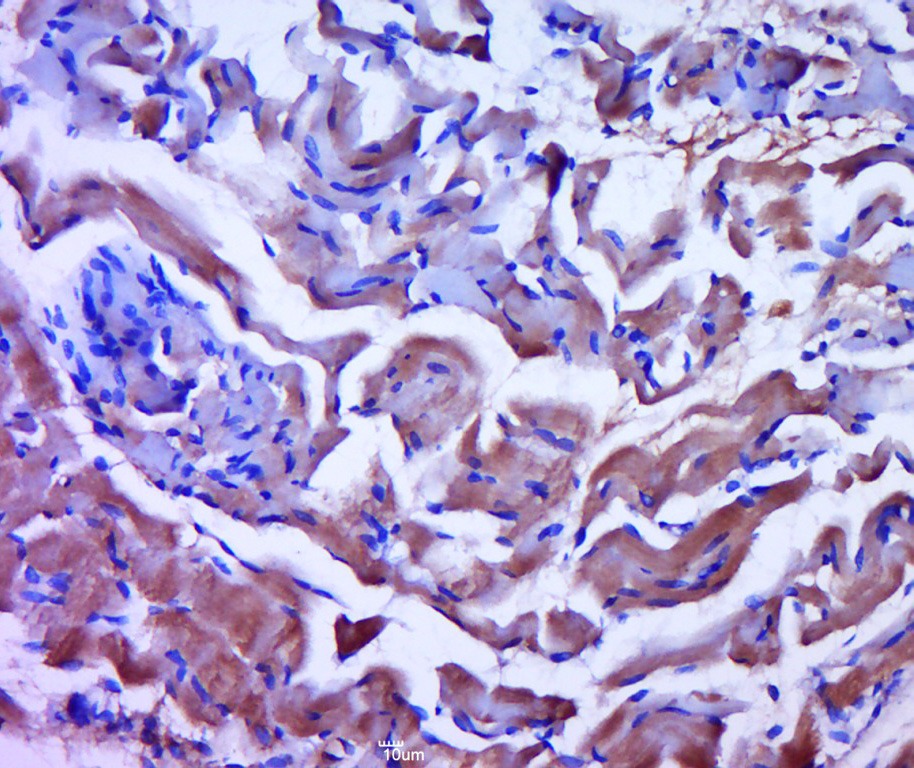 Anti-PYGM Polyclonal Antibody