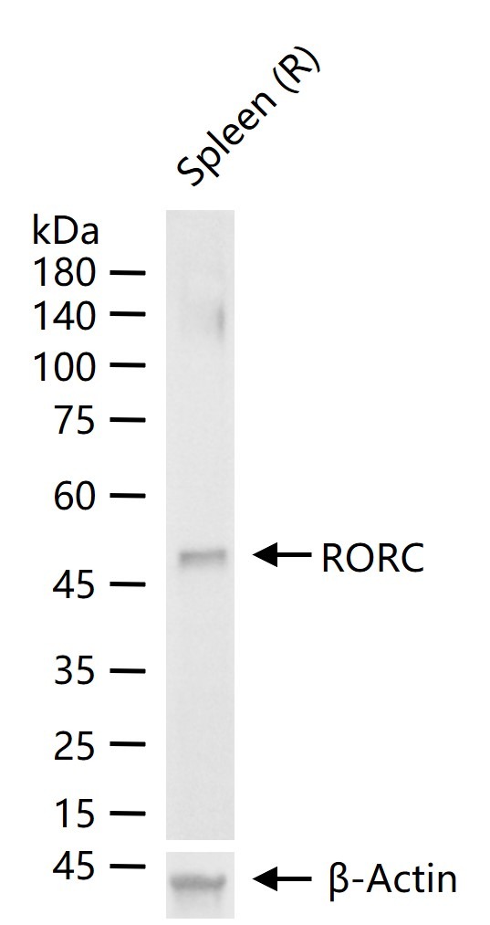 Anti-RORC Polyclonal Antibody 3