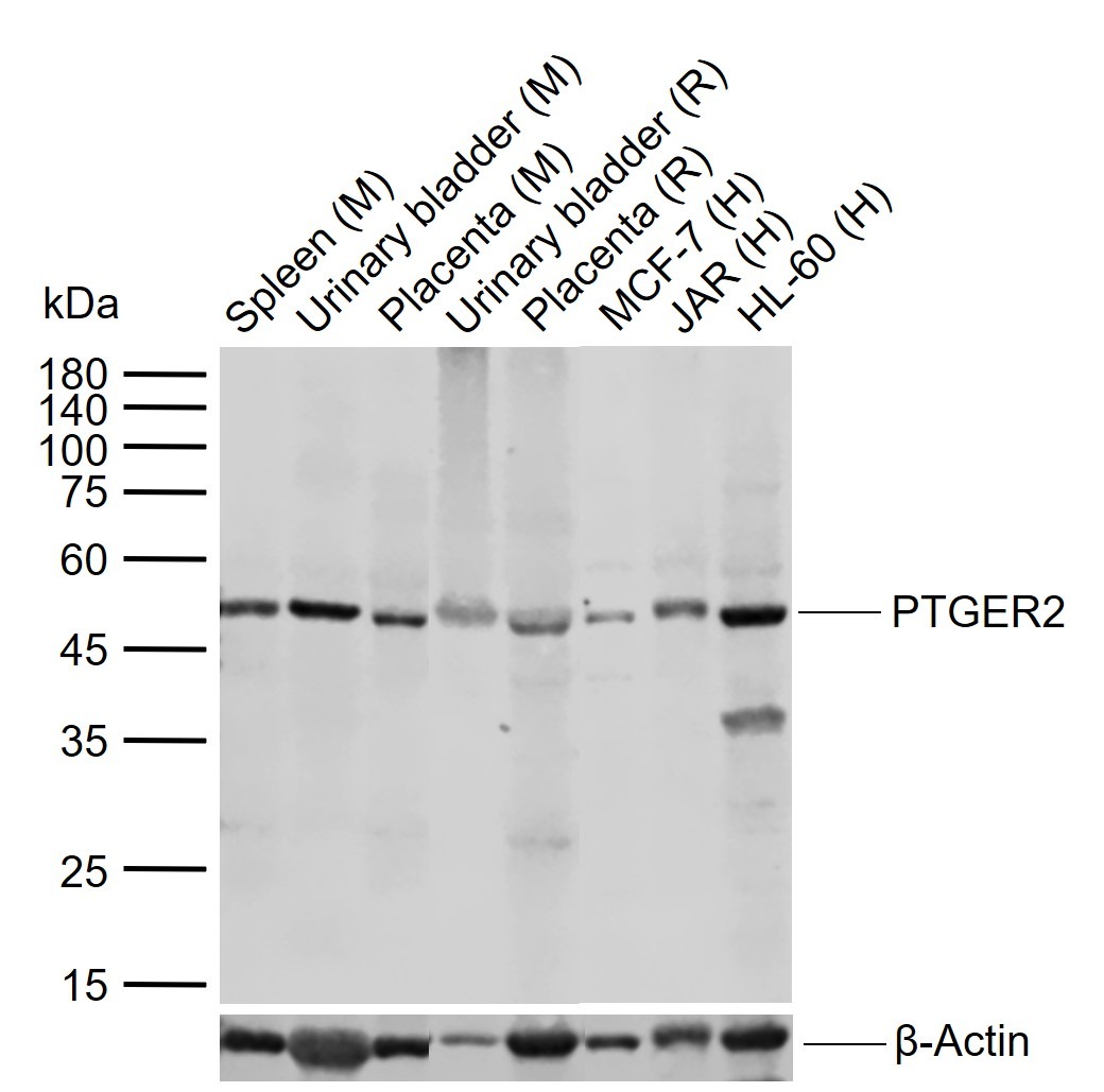Anti-PTGER2 Polyclonal Antibody