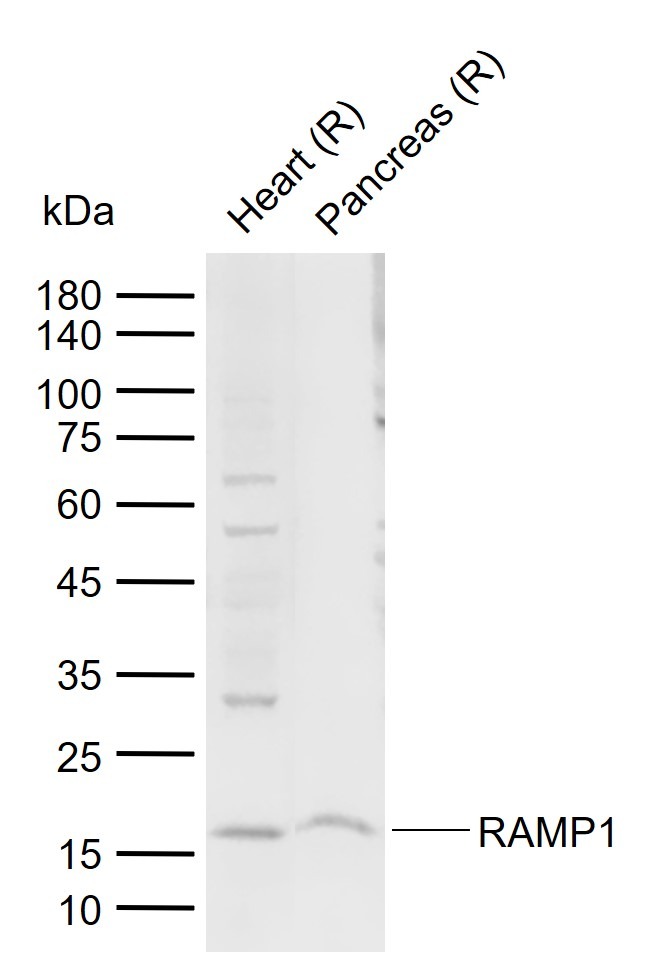 Anti-RAMP1 Polyclonal Antibody