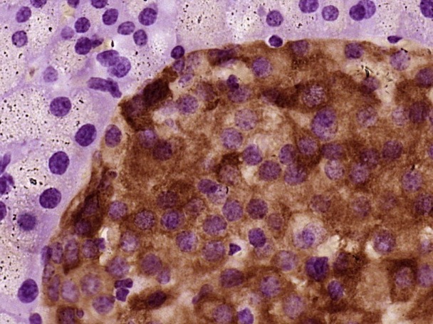 Anti-PRLR Polyclonal Antibody
