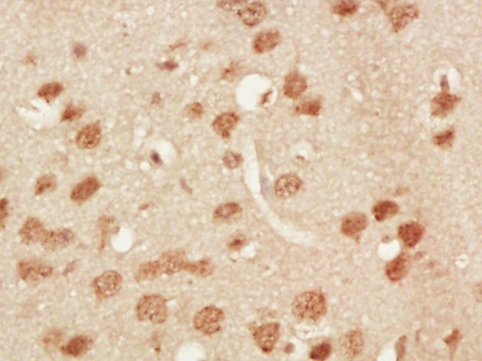 Anti-Phospho-TNIK (Ser764) Polyclonal Antibody