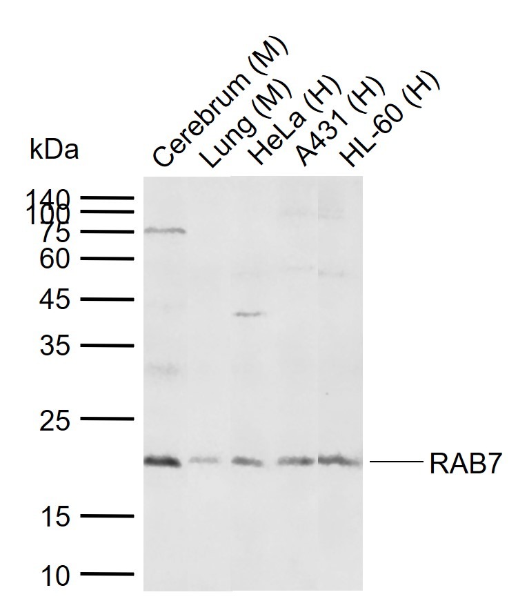 Anti-RAB7A Polyclonal Antibody
