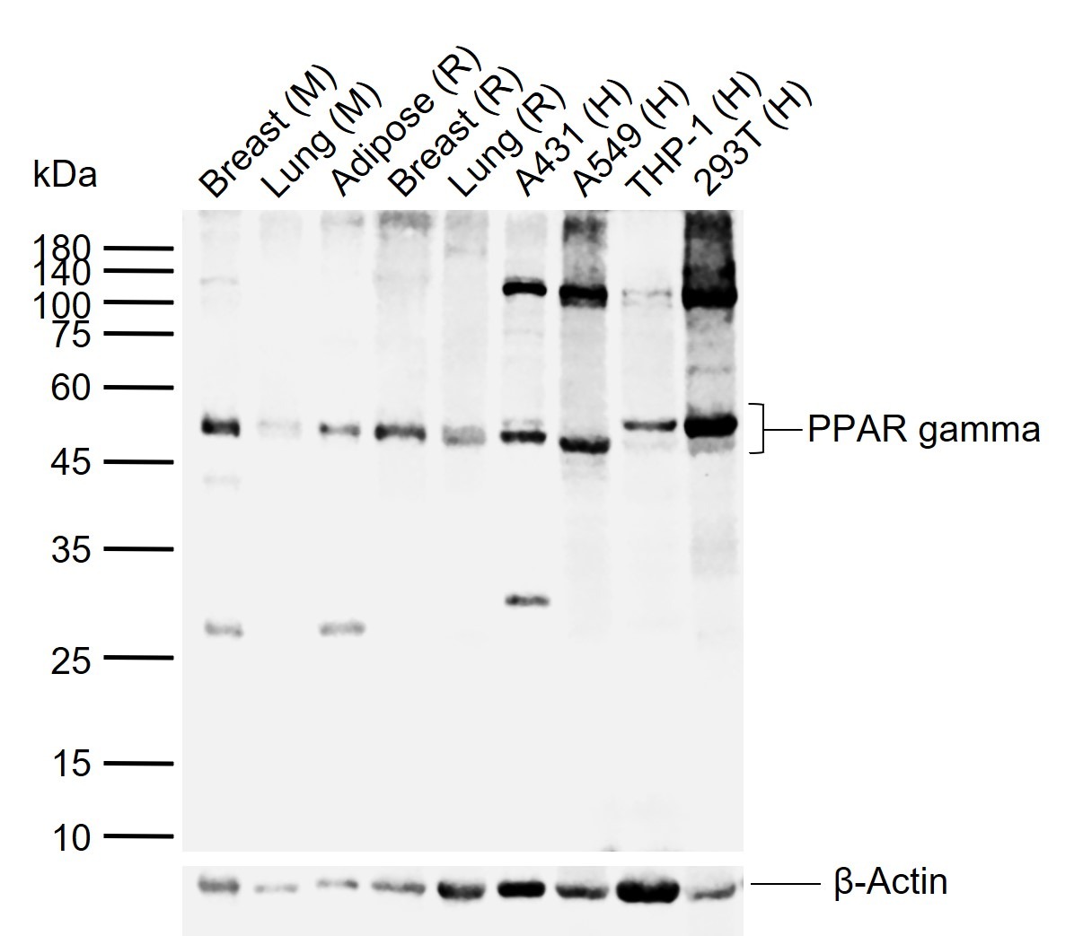Anti-PPAR gamma/PPARG Polyclonal Antibody