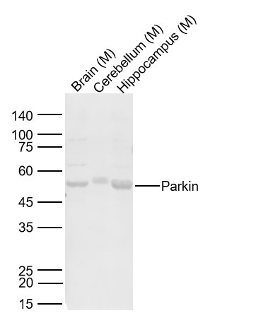 Anti-PRKN Polyclonal Antibody