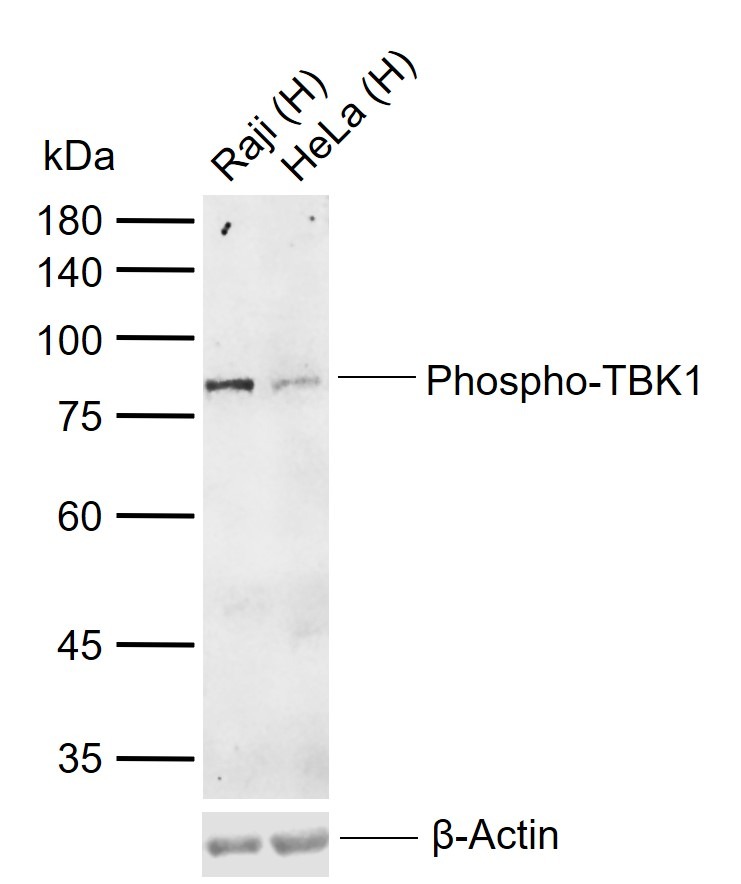 Anti-Phospho-TBK1 (Ser172) Polyclonal Antibody