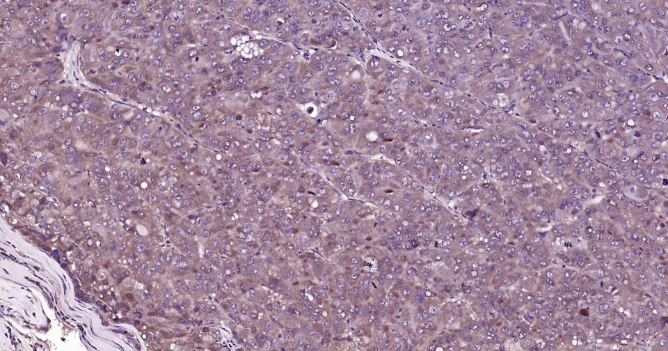 Anti-Phospho-TBK1 (Ser172) Polyclonal Antibody