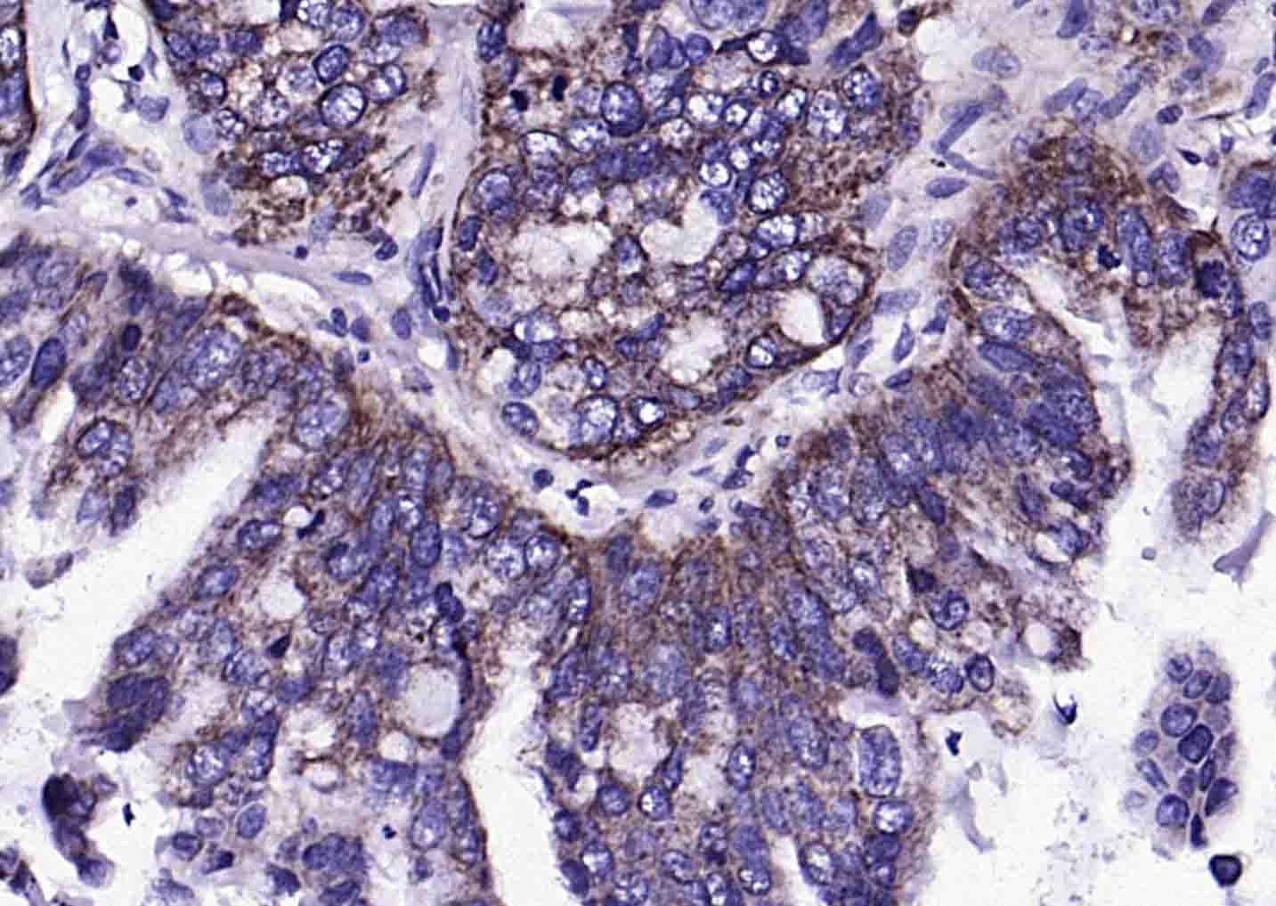 Anti-S100A10 Polyclonal Antibody
