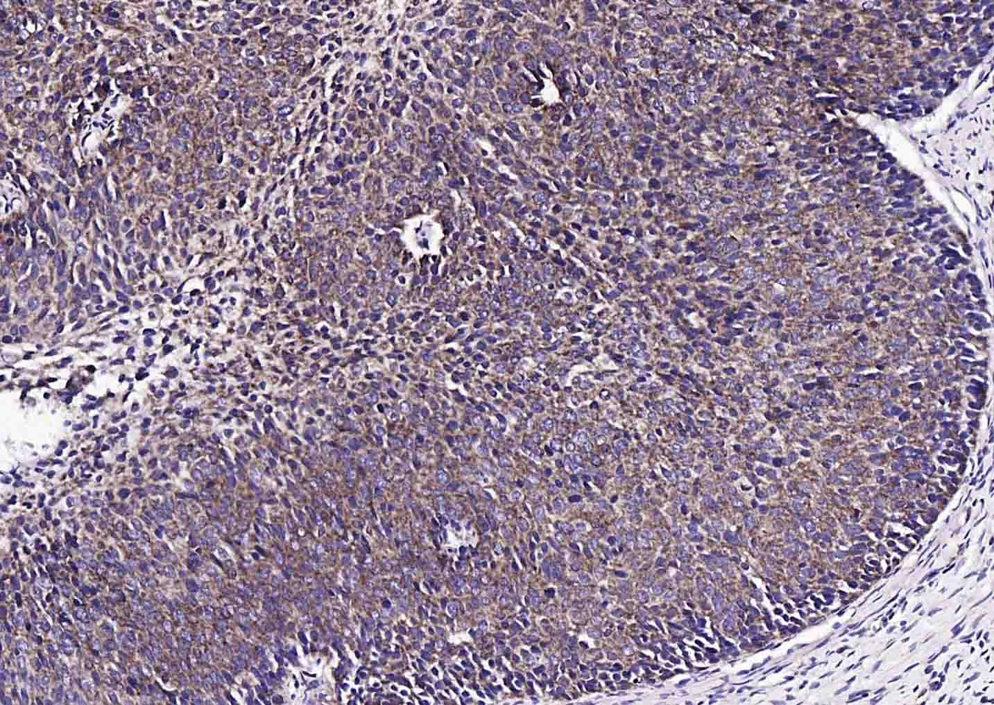 Anti-S100A10 Polyclonal Antibody