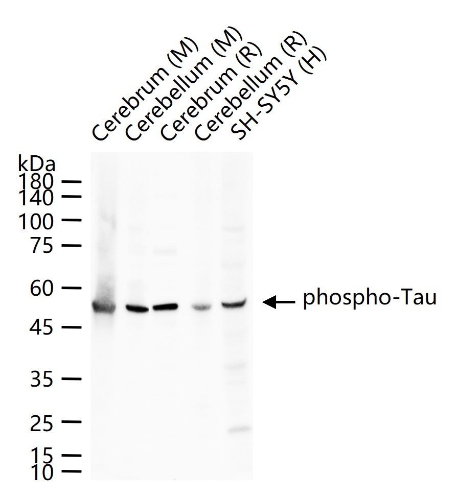 Anti-Phospho-Tau (Thr181) Polyclonal Antibody