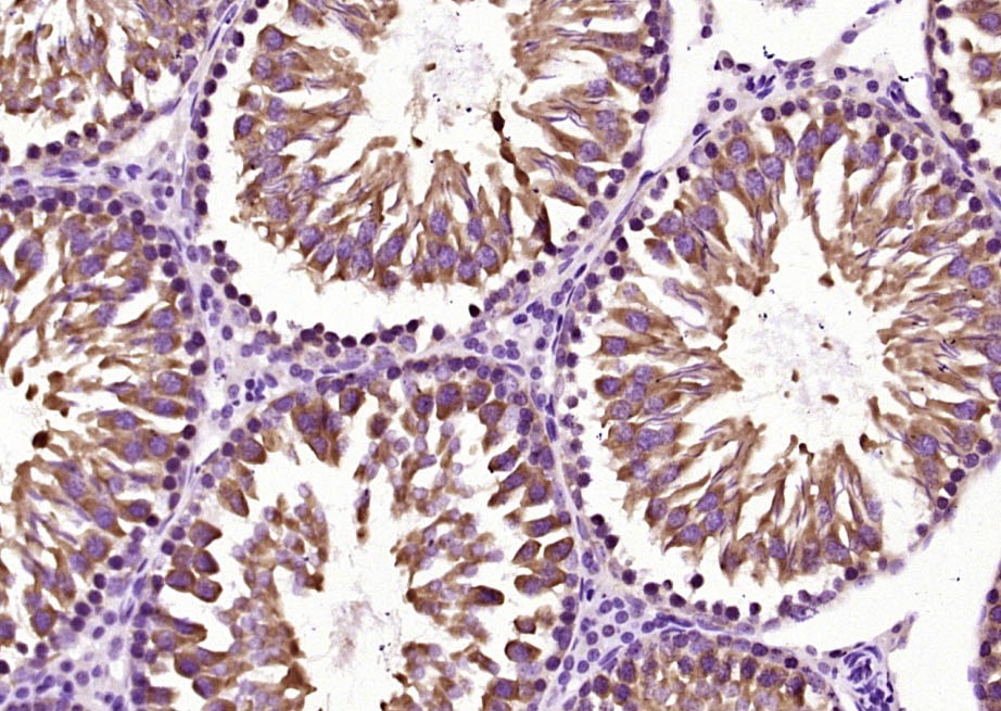 Anti-RAD51 Polyclonal Antibody