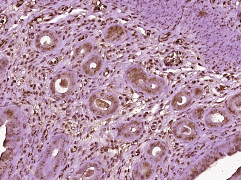Anti-Progesterone Receptor Polyclonal Antibody