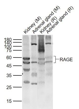 Anti-RAGE Polyclonal Antibody