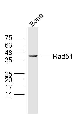 Anti-RAD51 Polyclonal Antibody