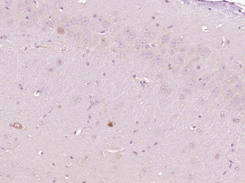 Anti-RAGE Polyclonal Antibody