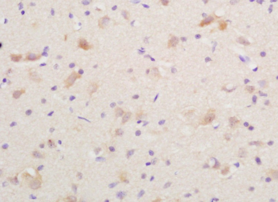 Anti-CGRP-I Polyclonal Antibody