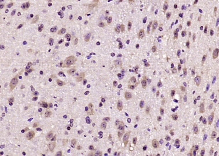 Anti-CGRP-I Polyclonal Antibody