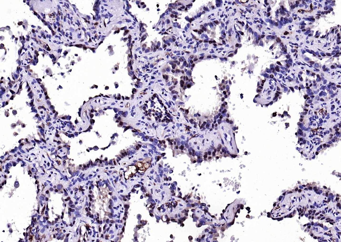 Anti-S100A8/9 Antibody (4J730)