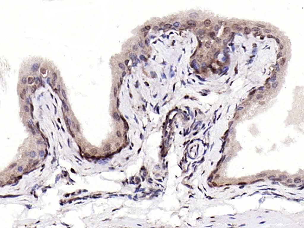Anti-S100A4 Polyclonal Antibody