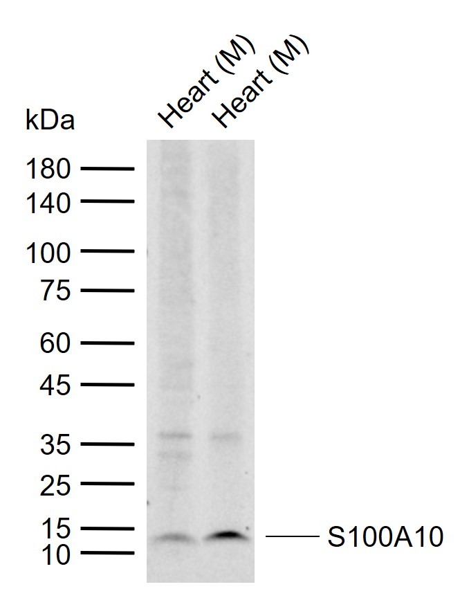 Anti-S100A10 Polyclonal Antibody